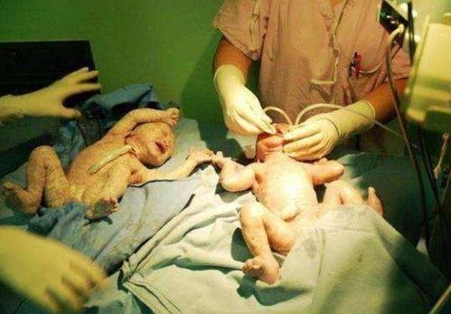 生孩子真实视频,见证生命诞生的震撼时刻