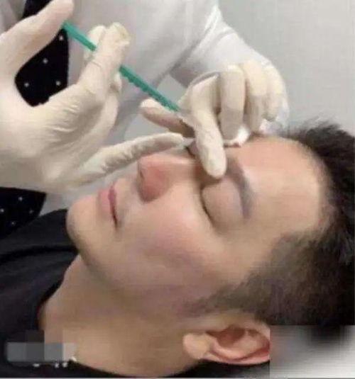 给自己打针视频,跟随视频轻松掌握注射技巧