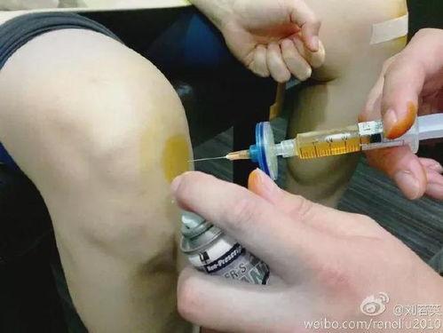 膝关节注射视频教程,膝关节注射操作步骤详解教程