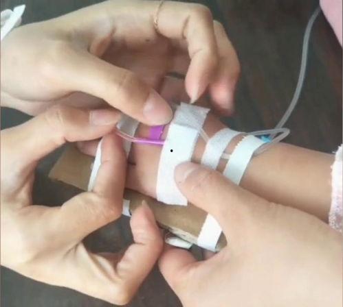扎针视频教程,视频教程详解